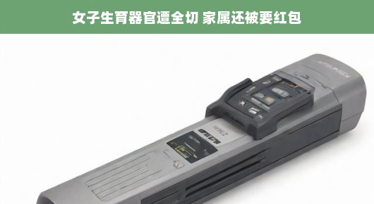 轻松面对困境，关于女子生育器官遭全切事件及其后续纷争
女子生育器官遭全切背后的故事