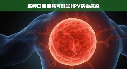 轻松解读口腔溃疡背后的HPV病毒感染可能性