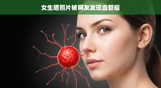 女生晒照片意外揭示血管瘤，一次网络健康的启示