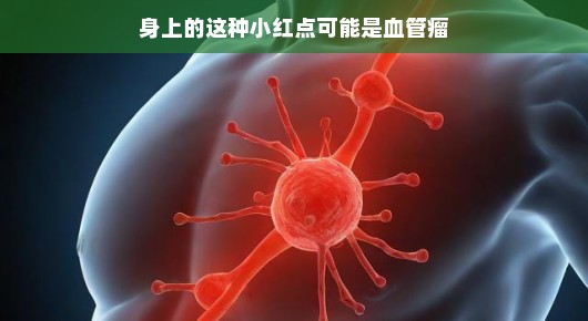 身上的小红点与血管瘤的可能性探讨