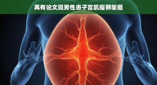 再探男性患子宫肌瘤与卵巢癌，论文揭示新发现